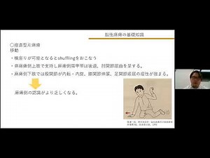 ダイジェスト動画 脳性麻痺のリハビリテーションの基礎知識 ＜リハビリ部門コンサルティング・リハビリ技術セミナー・キャリアコンサルティングの株式会社Work Shift＞