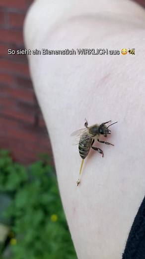 🐝 So sieht ein Bienenstich wirklich aus 😳Wusstest du, dass die Biene ihren Stachel danach verliert? Keine Sorge — den Bienen geht es nur um Schutz ihres Volkes 👑 #bienen #bienenstich #imkerei #beekeeping #honig