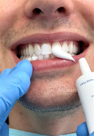 The Benefits of Holy Deer Toothpaste for Oral Health