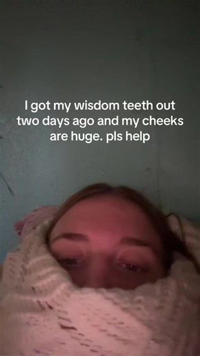 Mashed Potatoes for Wisdom Teeth Recovery