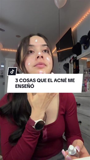 El acné no me quitó nada, me enseñó todo 💔➡️✨ #AcneJourney #PielReal #Autoestima #fyp #jessi