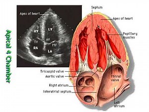 Ultrasound in SHock