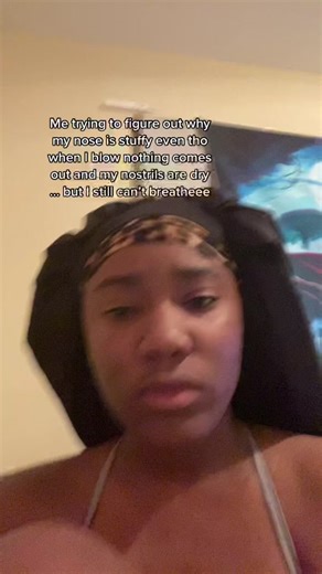 Google said I have a tumor growing in my sinuses 🧎🏽‍♀️⚰️ #fyp #CatOnALeash #foryou #fypシ #HPSustainableSounds #nose #nostrils #sinuses