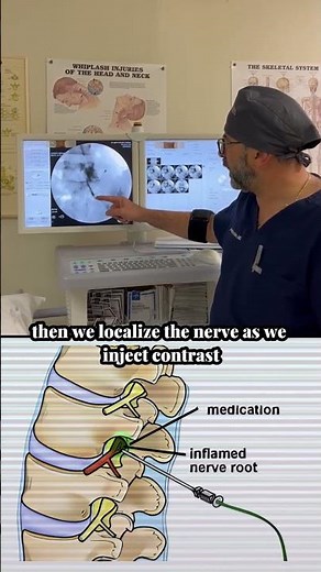 10-Minute Sciatica Relief ⚡️ | Selective Nerve Root Block (Part 2)