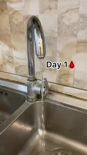 Understanding Menstrual Flow: What to Expect During Your Cycle