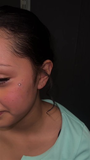 Surface Piercing Aftercare: Iodine Staining Explained