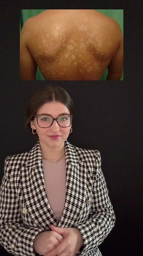 Understanding Skin Conditions: Insights and Management Tips