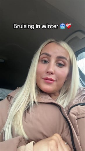 LETS TALK BRUISING IN WINTER 🥶 Bruising and swelling are a very common side effect of injectable treatments. Your vessels are a lot more fragile in winter due to the cold temperatures 🥲 Here’s how to help reduce those bruises: • Avoid caffeine 24hrs before your app • Avoid alcohol & smoking for 48hrs pre & post appointment • Avoid blood thinning medication (if safe to do so) • Utilising supplements like Bromelain (if safe to do so) • Arnica will also be your best friend ❤️‍🩹 Everyone’s prep &