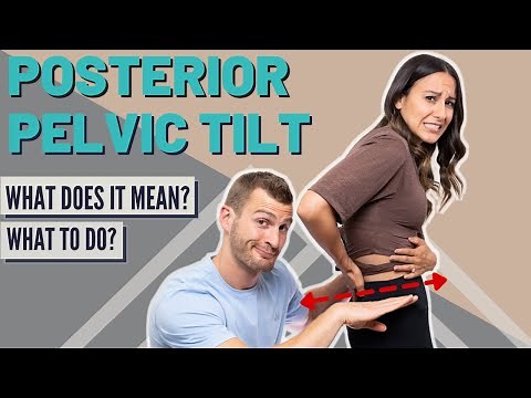 Posterior Pelvic Tilt | What Does It Mean & How To Fix It!