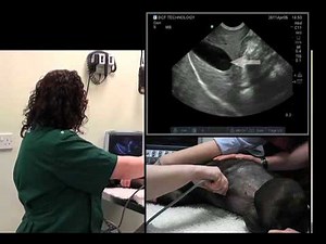 IMV imaging Abdominal Ultrasound Video 4 - Ultrasound exam of the liver