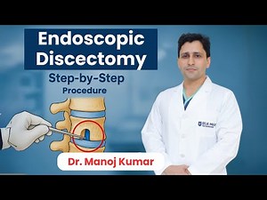 Endoscopic Discectomy (Step by Step Procedure) | Dr. Manoj Kumar