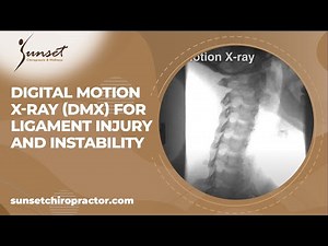 Digital Motion X-ray (DMX) for Ligament Injury and Instability