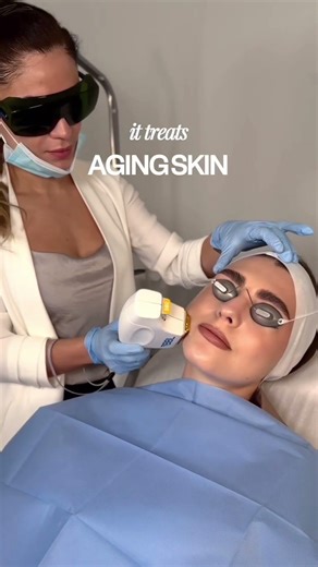 BBL Forever Young: Advanced Skin Rejuvenation with Broadband Light