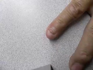 (72) Finger Nail Time Lapse Growing