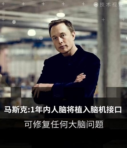 一年内人脑将植入脑机接口#AI #趋势 #人工智能 #企业思维 | The Champ 大赢家