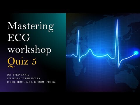 ECG QUIZ - 5