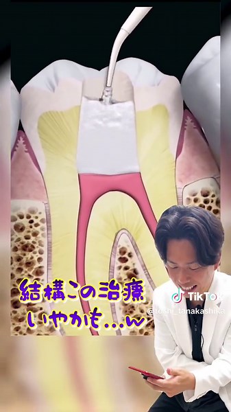 あなたの歯は大丈夫？ #歯医者 #虫歯 #虫歯治療 #白い歯になりたい #痛い