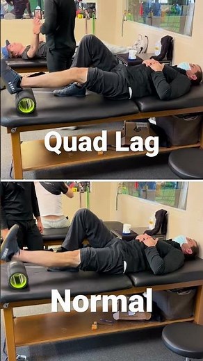 Quad Lag | Knee Extensor Weakness | Quad Deficiency