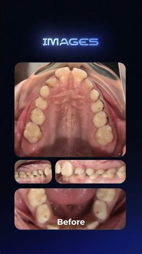 Invisalign in Dulwich, London