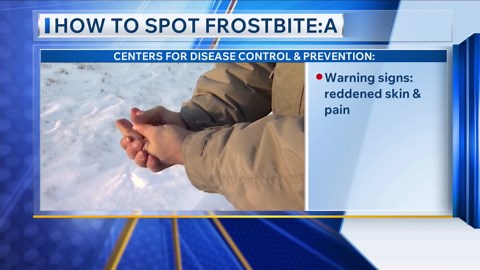 Tips on spotting and dealing with frostbite and hypothermia 12/4/2025