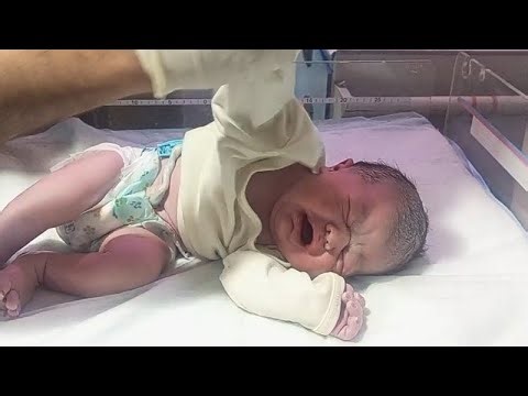 First Minutes of Life | Hypothermic Newborn with Meconium Aspiration Management