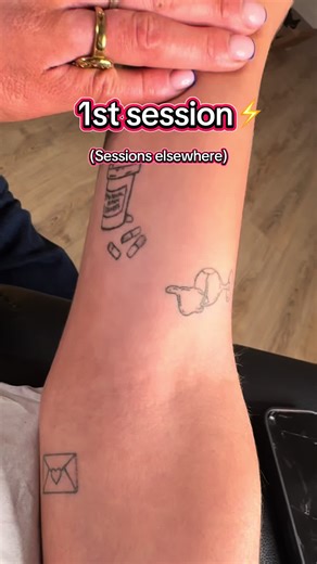 1st session ☺️⚡️thanks so much! Get in touch for a free quote. Discounts for multiple tattoos. A consultation & patch test must be booked first before a full treatment. 📆 - https://reviselaser.aesthetidocs.app 📧 - info@reviselaser.co.uk 🌐 - www.reviselaser.co.uk 📞 - 0131 210 0303 💬 - 07446717907 #LaserTattooRemoval #TattooRemoval #fyp #edinburgh #laser