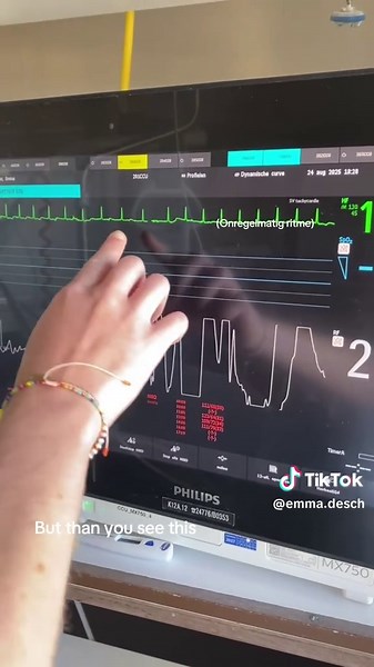 Hartgezondheid: Wat Je Moet Weten