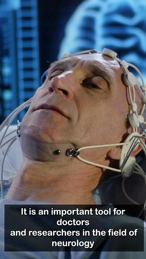 What is Electroencephalography (EEG)? #neurotech