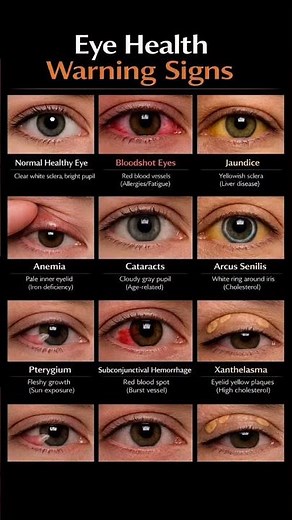 🚨 Red Eye or Sudden Vision Loss? Don’t Ignore This.