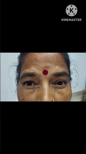 Blepharospasm. It is a focal dystonia causing forceful closure of eyelids.