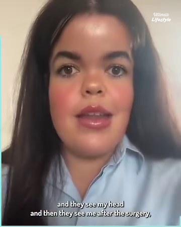 I got forehead reduction surgery but people say they can’t see a difference 😳 | Ultimate