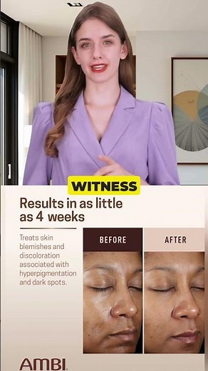 Is Ambi Fade Cream the Secret to Clear Skin?