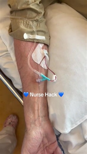 Handige Nurse Hack voor Chemotherapie Controle
