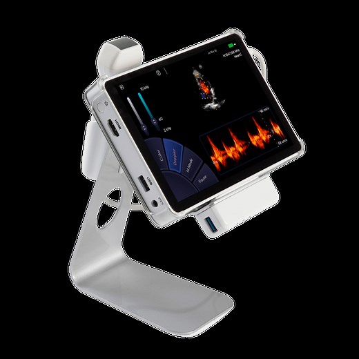 U-Lite PRO - HandHeld Ultrasound Scanner - Sonoscanner