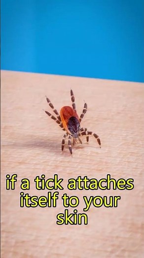 Tick Attached to Your Skin? Avoid This Common Mistake!