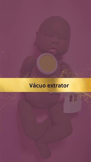Tudo sobre o Vácuo Extrator no Parto