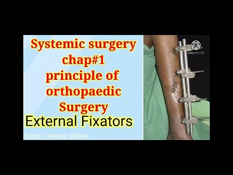 External fixator system @TamknatPhysioRehab #Orthopaedic implants