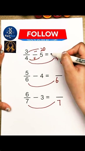 🧠 Fraction Minus Whole Number Trick! 😱 Only 1% Can Solve It Correctly