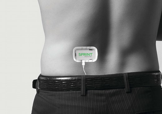 SPRINT® Peripheral Nerve Stimulation | Twin Cities Pain Clinic