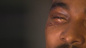 Pastor attacked and beaten on church property