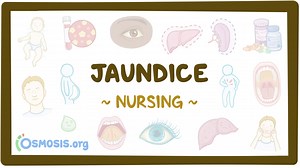 Jaundice: Nursing: Video & Causes | Osmosis