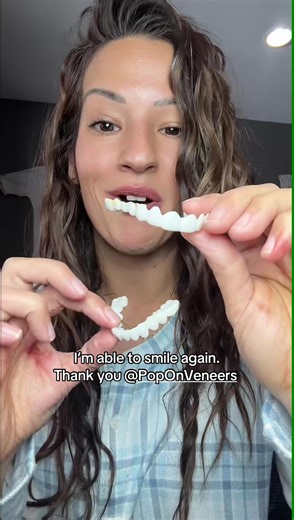 These veneers are LEGIT!🤩 | Pop On