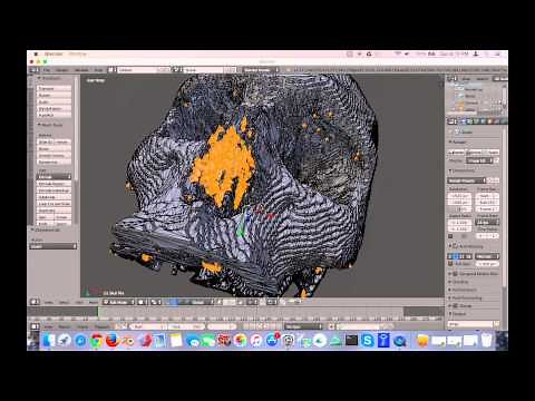 Creating 3D Printable Models from Medical Scans in 30 Minutes Using Free Software