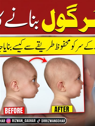 How to Safely Shape Your Baby's Head: Myths and Science