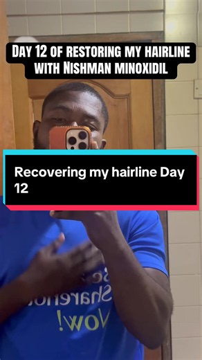 Day 12 of restoring my hairline with Nishman minoxidil ✅We want everything FAST but some things take time. Trust the process.Stay consistent.#hairgrowthjourney #nishmanminoxidil #maydenplug #minoxidil #day12 @BoNgO🐬 @General👏 boss💁🏽🇬🇭🇺🇸 @Maydenplug Backup ✅ @Mayden @MedScience 🫁🫀 🧠 🇬🇭