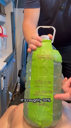 233 reactions · 44 comments | Fatigued makes a big difference!  Comment “workbook” to get our ECG workbook! #paramedic #paramedicstudent #paramedicschool #ems #emt #emtstudent | Master Your Medics | Facebook