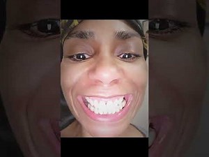 Gum Grafting Surgery