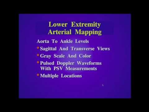 Doppler Evaluation of Peripheral Arterial Disease