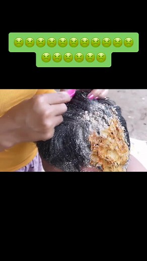 #foru#liceshowers#fypシ#nasty#dontthrowup#foryoupage#hair#lice