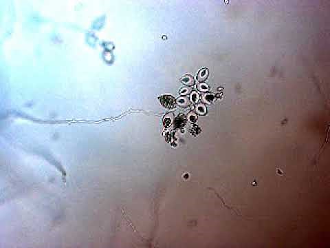 Phytophthora zoospore release 2